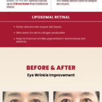 KSECRET - SEOUL 1988 Eye Cream : Retinal Liposome 4% + Fermented Bean - Image 5